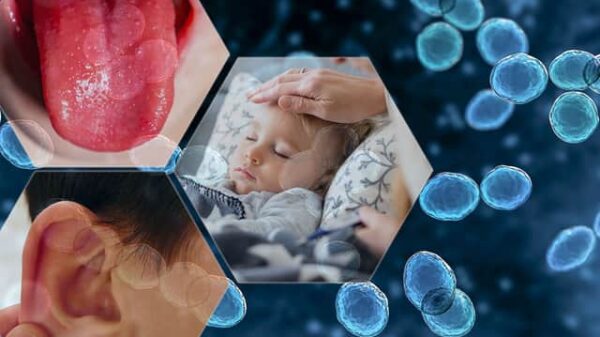 NWLD composite Strep A infection symptoms explained MH