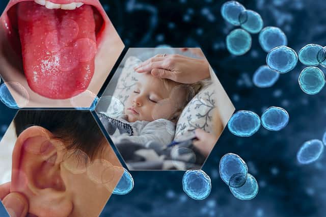 NWLD composite Strep A infection symptoms explained MH